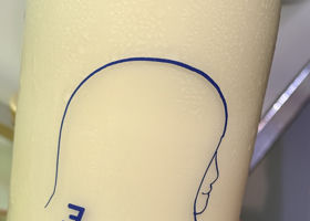 alt 1